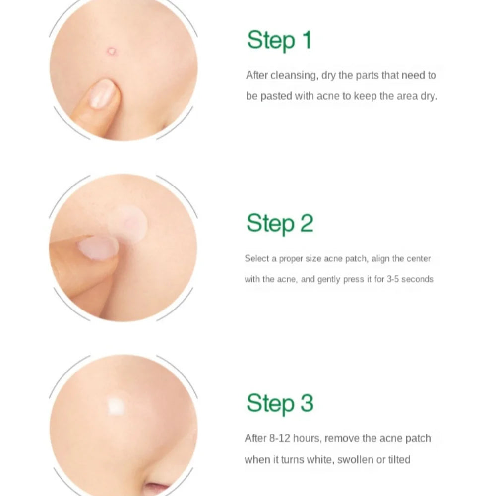 Artificial Skin Acne Removal Patch Invisible Transparent Pimple Patch Beauty Stickers Concealer Acne Cleansing Patch Scar Care