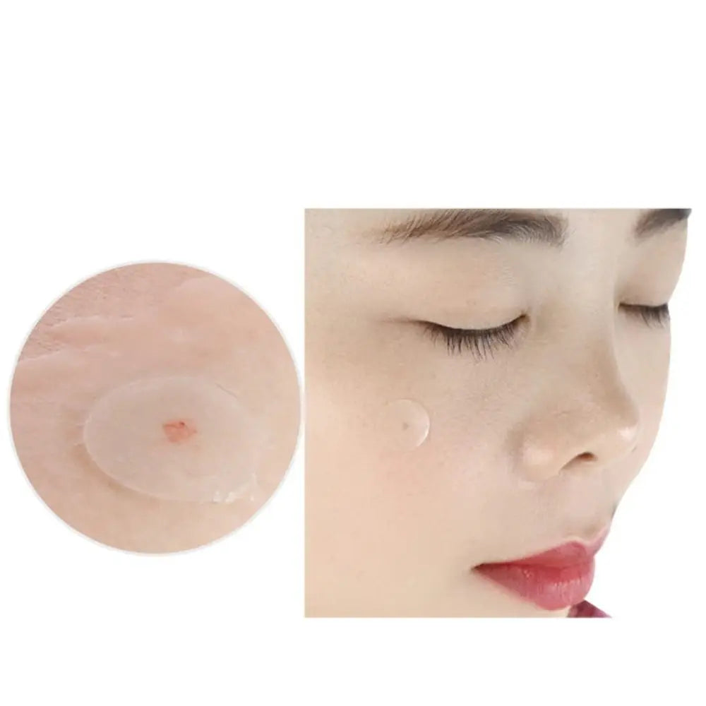 Artificial Skin Acne Removal Patch Invisible Transparent Pimple Patch Beauty Stickers Concealer Acne Cleansing Patch Scar Care